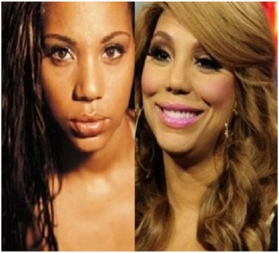 Tamar Braxton (Before & After)