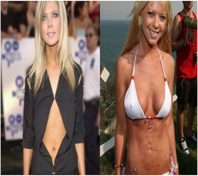 Tara Reid (Before & After)